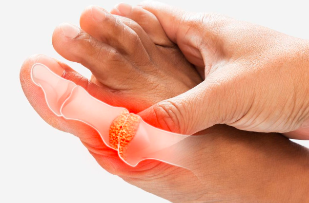 How to Prevent Big Toe Joint Pain