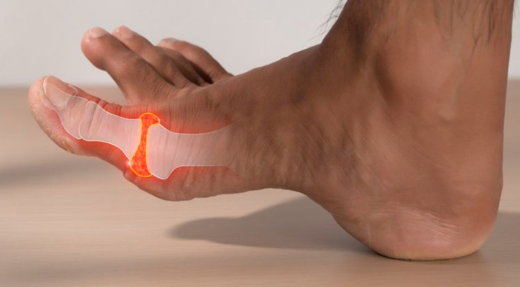 What Does Pain in the Big Toe Joint Mean?