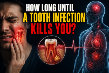 How Long Until a Tooth Infection Kills You