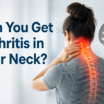 Can You Get Arthritis in Your Neck?