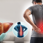 Will a Fatty Liver Cause Back Pain?