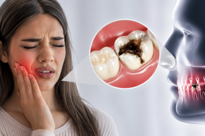 what does a cavity feel like​?