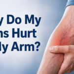 Why Do My Veins Hurt in My Arm?