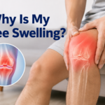 Why Is My Knee Swelling?