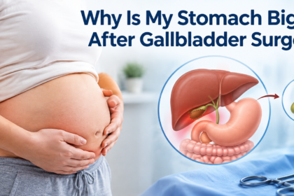 Why Is My Stomach Bigger After Gallbladder Surgery?
