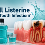 Will Listerine Kill Tooth Infection?