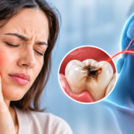 Can a Cavity Cause a Headache?