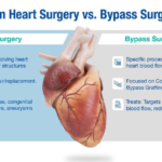 a Bypass the Same as Open Heart Surgery?