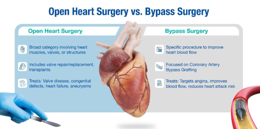a Bypass the Same as Open Heart Surgery?